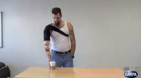 Crean prótesis que devuelve sensibilidad a amputados (video)